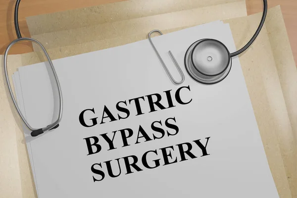 What is Gastric Bypass Surgery?